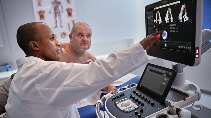 Philips lanza Transcend Plus para EPIQ CVx y Affiniti CVx, que ofrece una calidad de imagen innovadora y mejoras de IA aprobadas por la FDA en ultrasonido cardiovascular